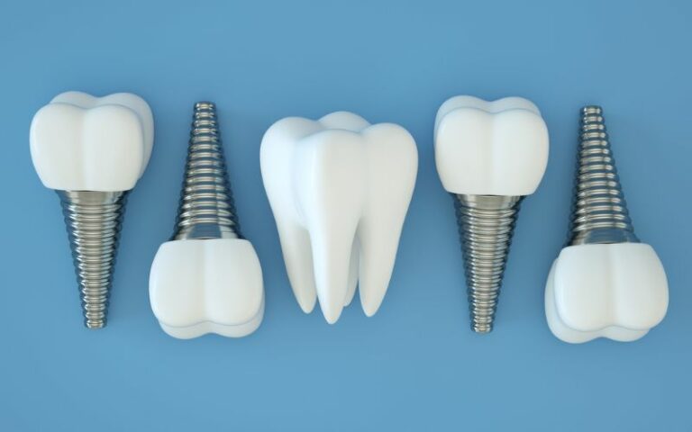dental implants laying next to each other in a pattern for visual effect