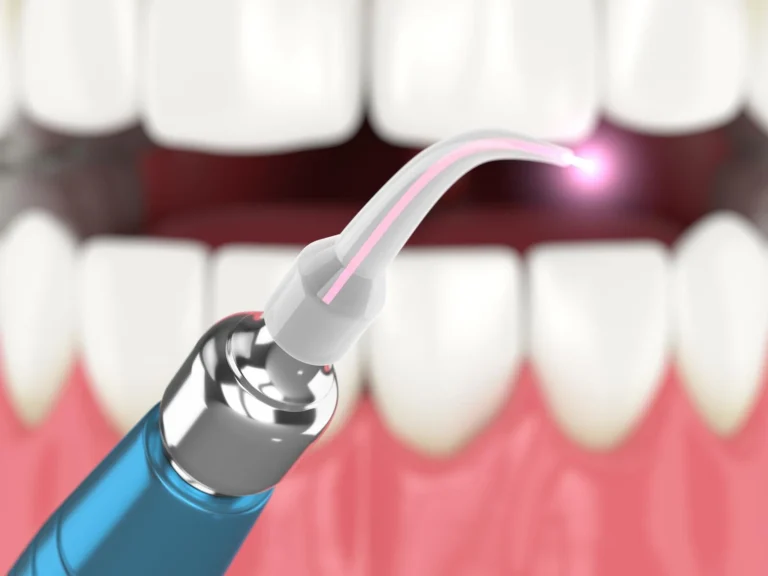 diode laser treatment for cold sores